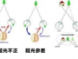 弱视存在这些“隐匿” 症状