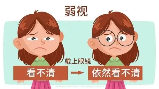 配镜不准确？！这些伤害让孩子“伤不起”！(图4)