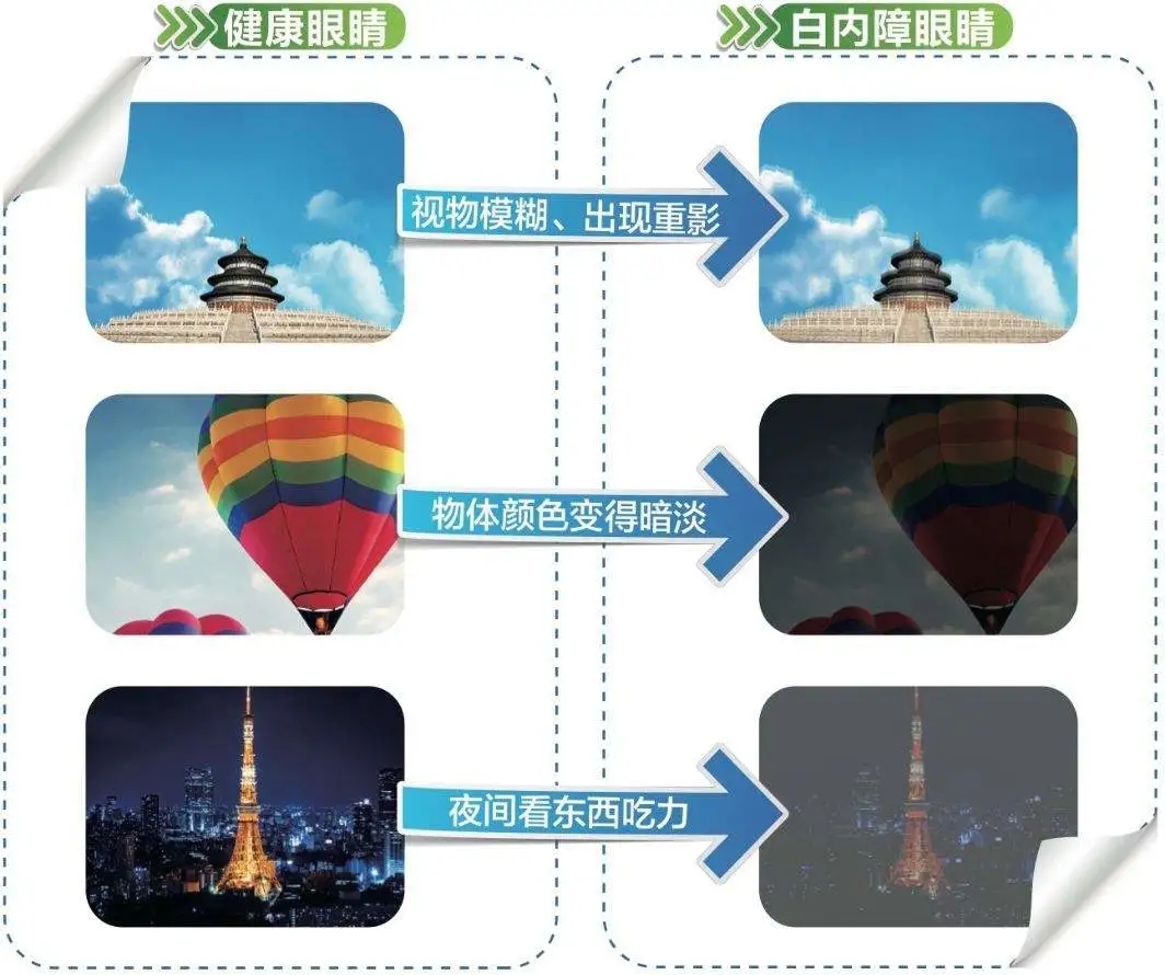 老年人要警惕“老眼昏花”！(图2)