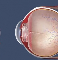 感冒可能“殃及”视神经！突然视力减退、眼球痛要警惕！