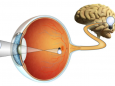 中西医结合治疗视神经炎 避免反复发作