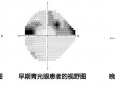 青光眼就是这样一步步“偷走视力”